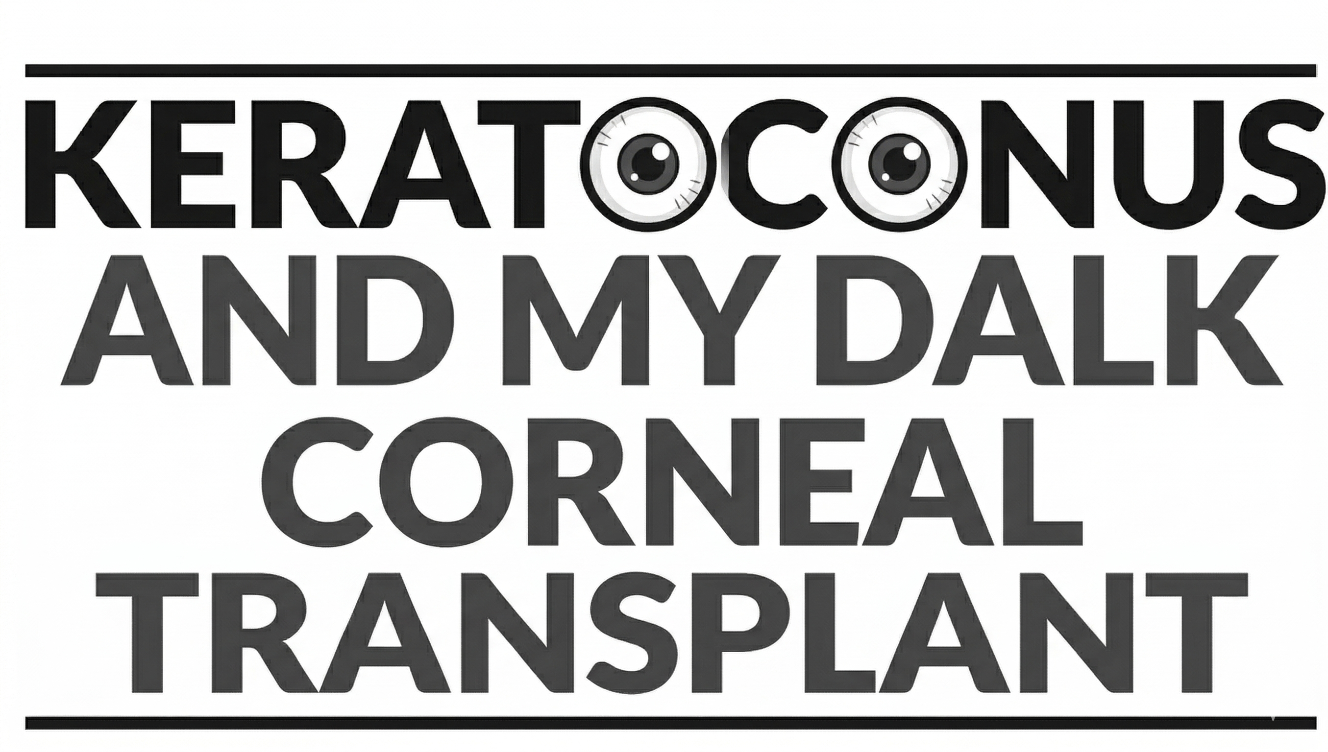 Keratoconus and my DALK Corneal Transplant